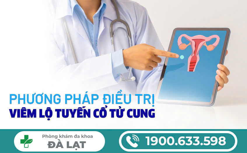 Các phương pháp chữa viêm lộ tuyến cổ tử cung